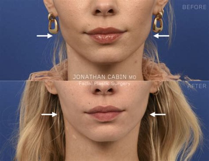 Can TMJ affect your legs?