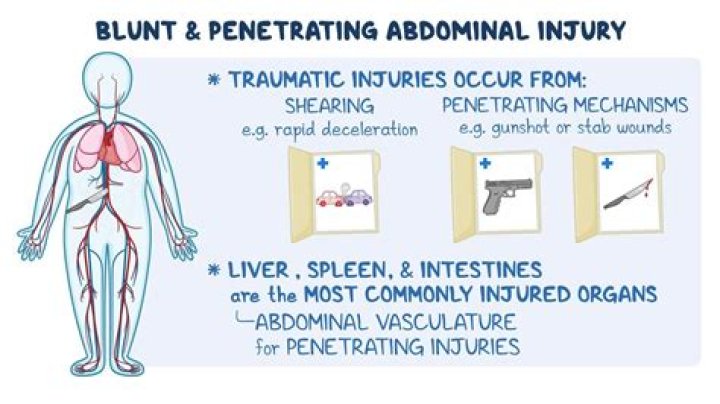 What is an abdominal wash?